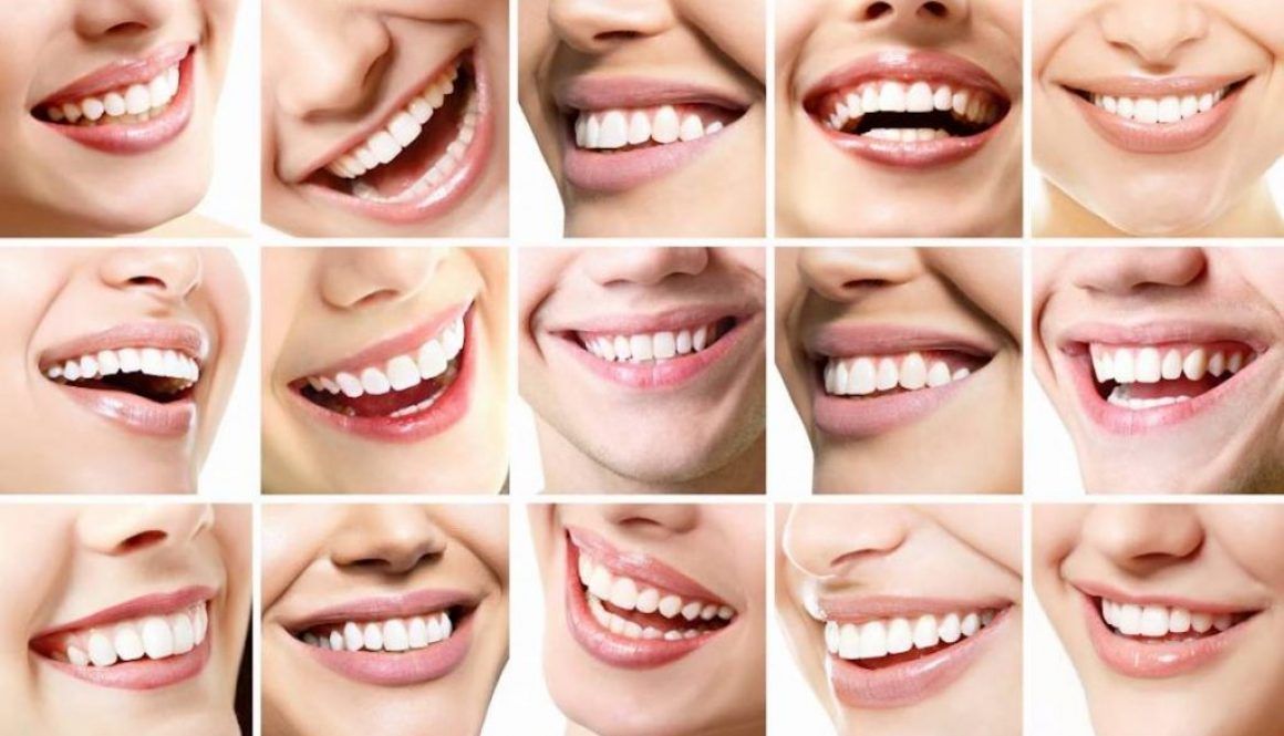 Co kształt zębów mówi o Twoim charakterze? 